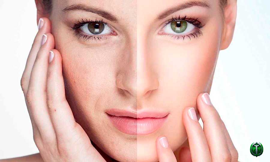 Шлях до бездоганної шкіри: як позбутися розширених порів на обличчі