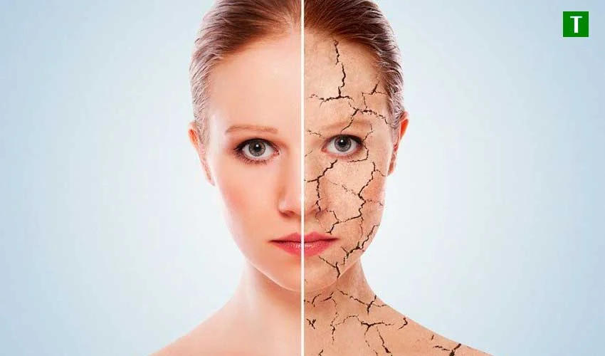 Кожные заболевания: Как сохранить кожу здоровой