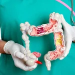 Проктологические заболевания: основные аспекты и лечение