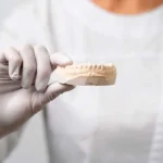 Навіщо потрібні зубні коронки