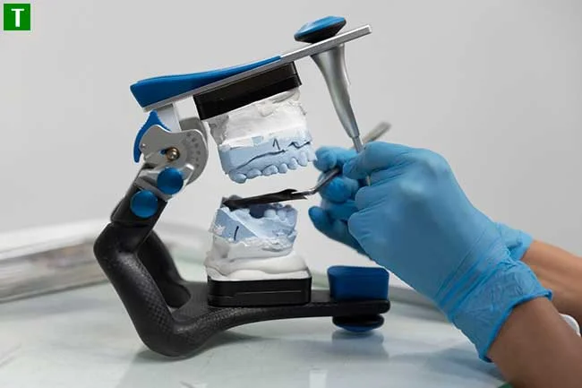 Значення аксесуарів у процесі 3D друку в стоматології