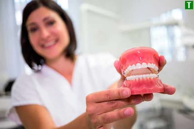 Що таке зубні імплантати?