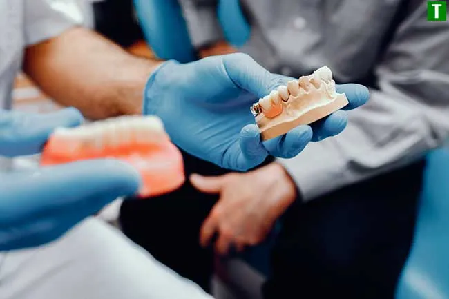 Порівняння імплантатів з іншими методами відновлення зубів