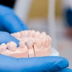 Імплантація – відновлення втраченого зуба